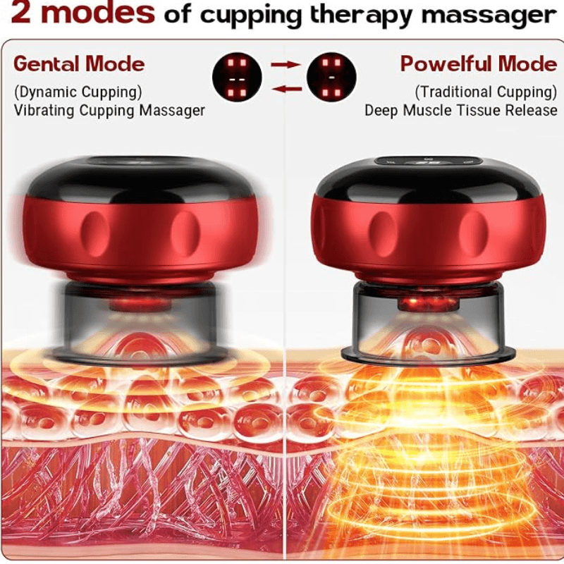 SootheGlide™ Electric Vacuum Cupping Massager